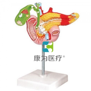 “康為醫(yī)療”病理模型胰腺模型，十二指腸和膽囊模型