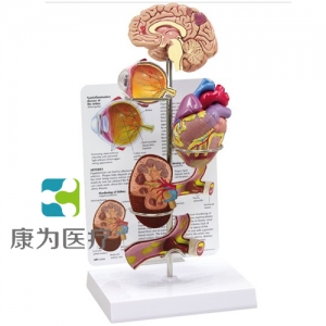 “康為醫(yī)療”醫(yī)患關系溝通模型-微型腦、眼、心、腎及動脈模型 （醫(yī)學指導模型）