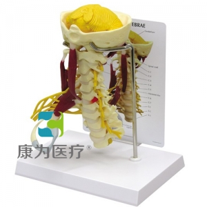 “康為醫(yī)療”醫(yī)患關系溝通模型-頸椎帶神經(jīng)、肌肉附小腦模型 （醫(yī)學指導模型）